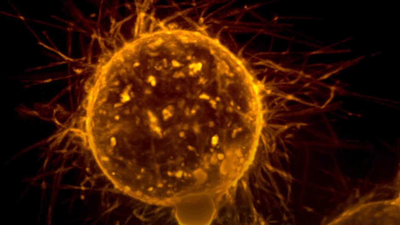 Image for read more article ''