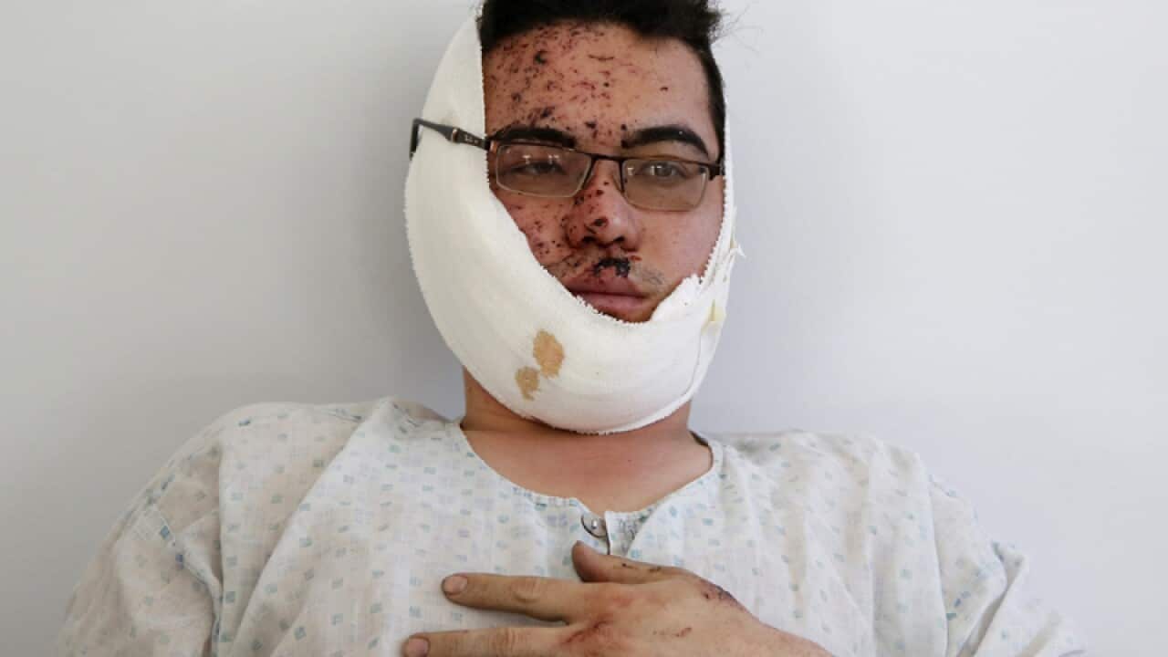 An Afghan man injured in a bomb blast is treated in hospital