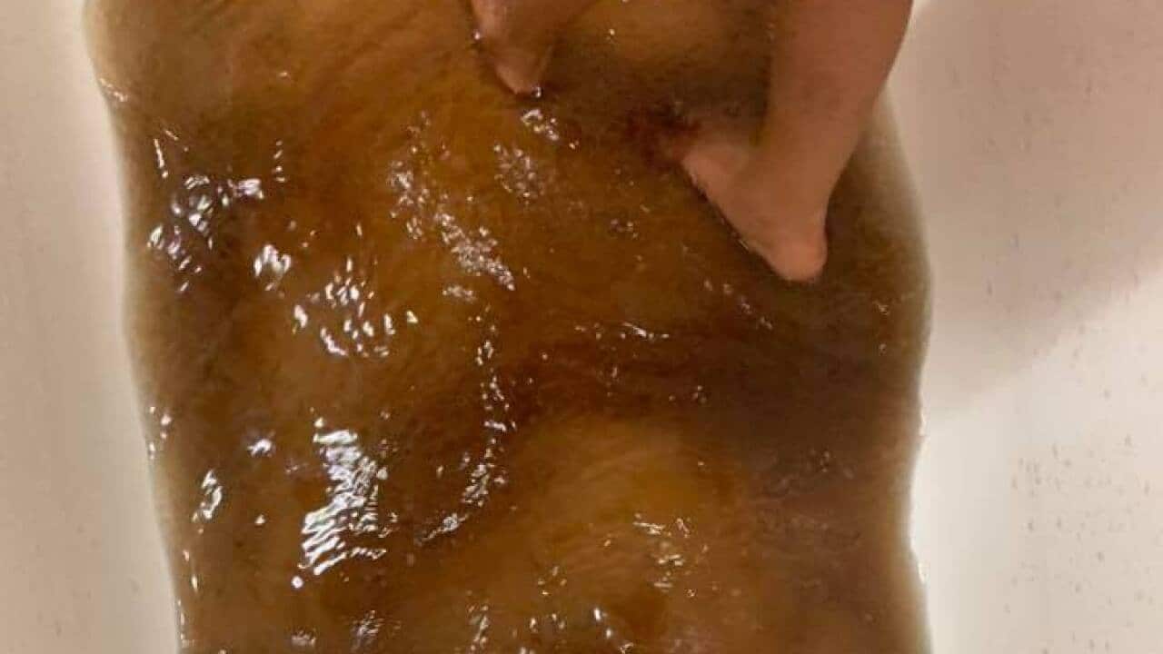 Image for read more article 'MORE ON THIS:'