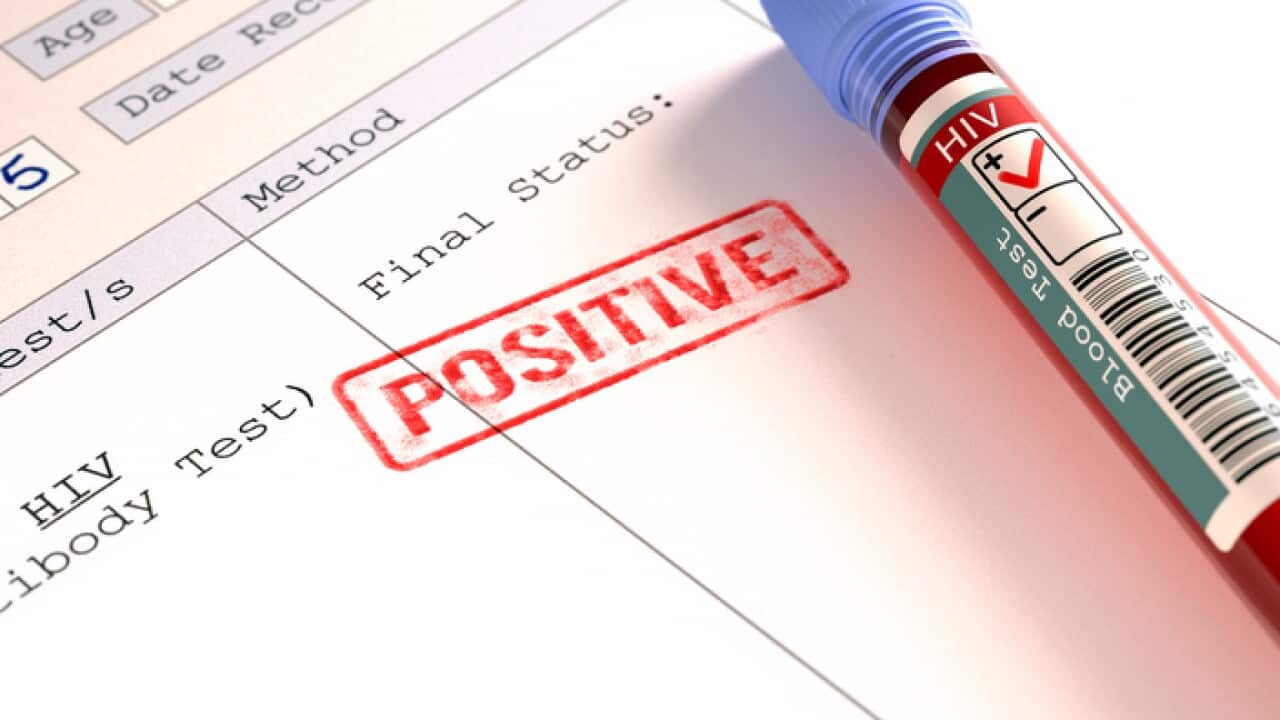 A positive HIV blood test