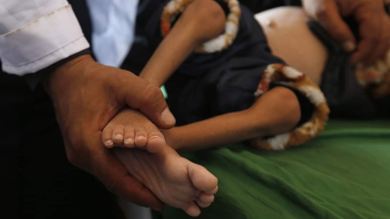 A Yemeni doctor treats a malnourished child in a Sana’a hospital.