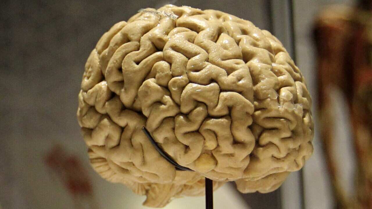 The human brain, on exhibition (AAP)