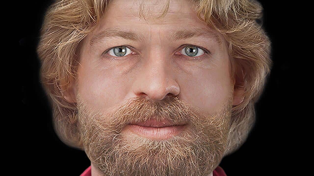 magnus facial reconstruction