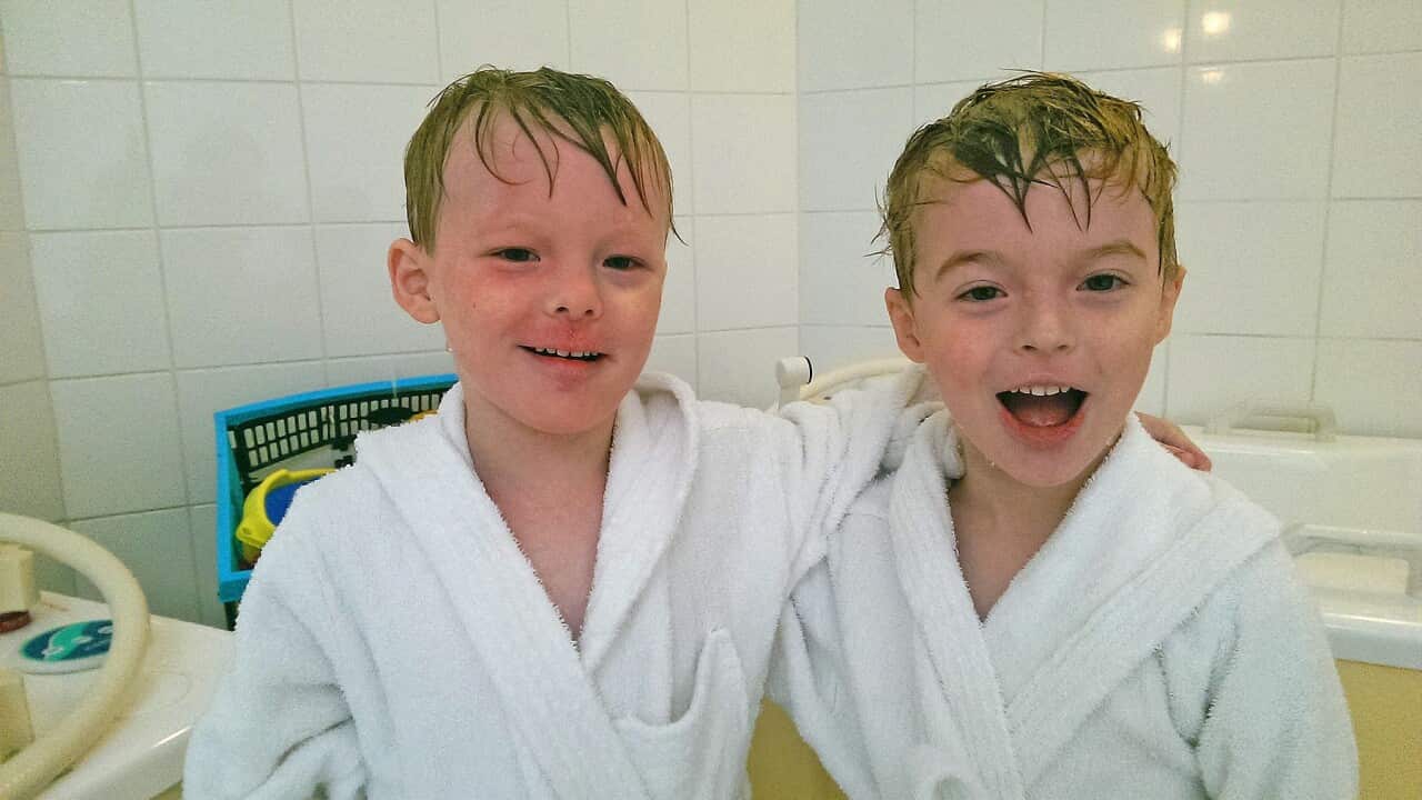 Twins Harry and Matthew were born with severe eczema (image supplied).jpg