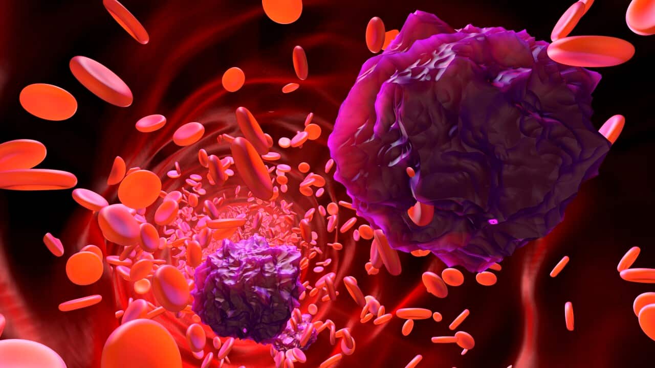 3D rendered Illustration of Leukemia cells in the blood stream