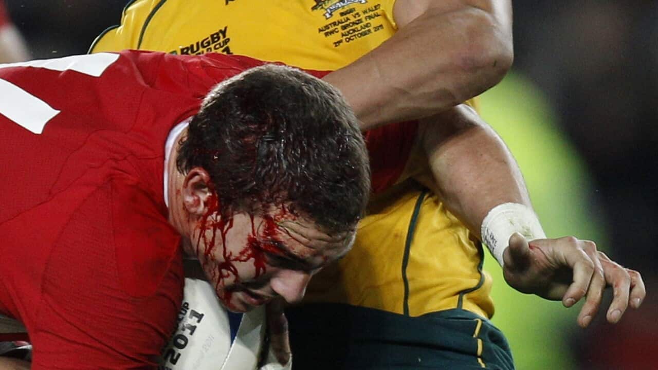 RWC Rugby Head Injuries