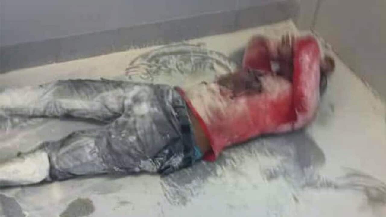 AAP Image/Supplied by Shamindan Kanapadhi