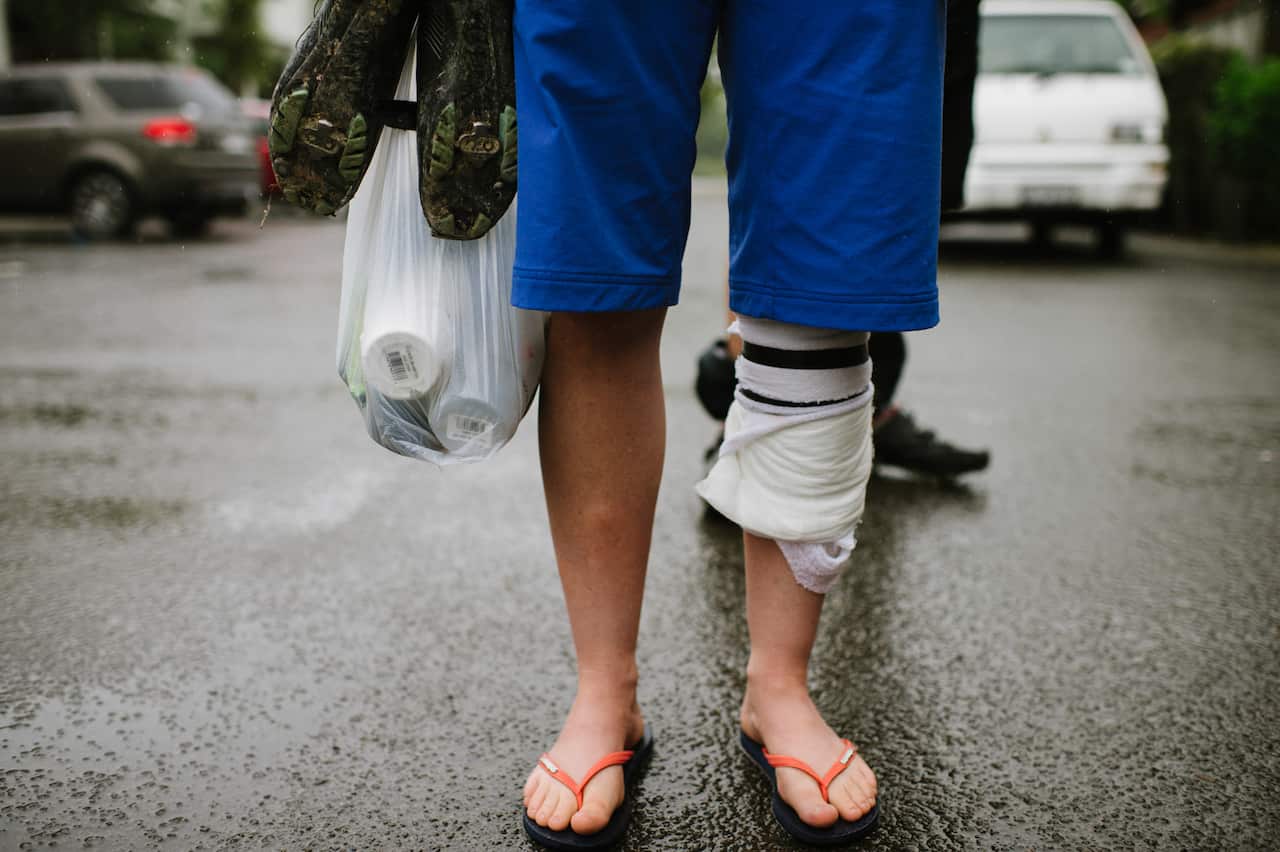 A bandage is held onto the calf with electrical tape