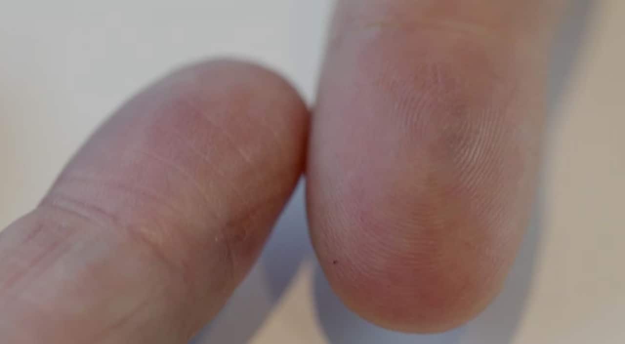 Fingerprints