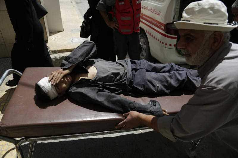 Abdulmonam Eassa's photo of an injured boy arriving at hospital in Eastern Ghouta.