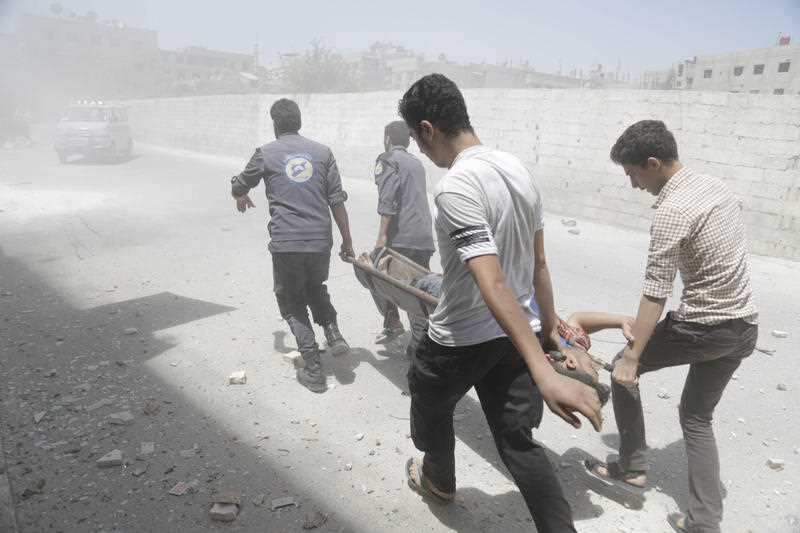 Abdulmonam Eassa's photo of an injured man on a stretcher in Eastern Ghouta.