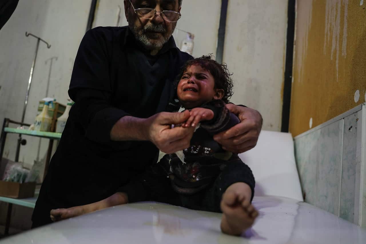 A child injured in a shelling is treated at hospital in Douma, Eastern Ghouta, 