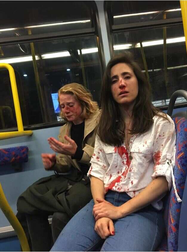 Melania Geymonat (r) and her girlfriend Chris after the alleged attack.