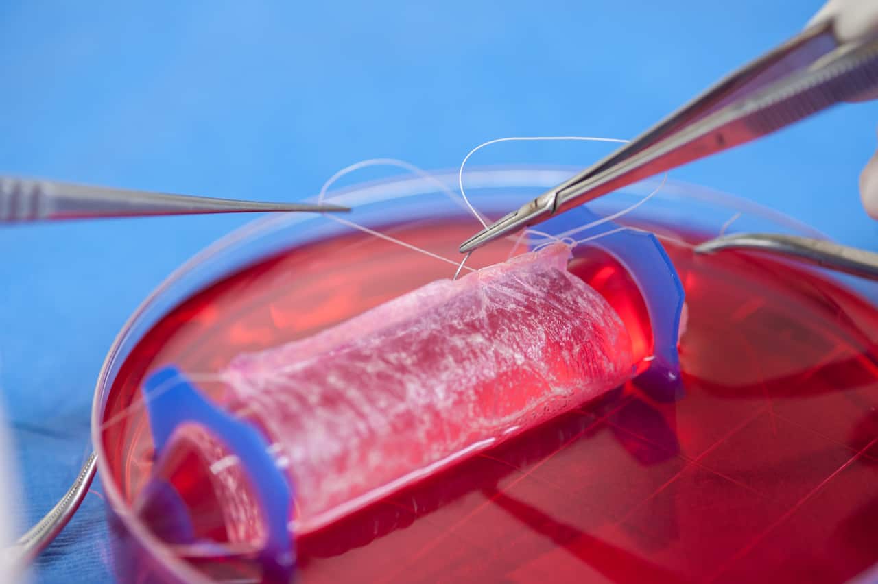 Cells are placed onto biodegradable “scaffolds” which are hand-sewn into a vagina-like shape. (Photo: Wake Forest Institute for Regenerative Medicine)