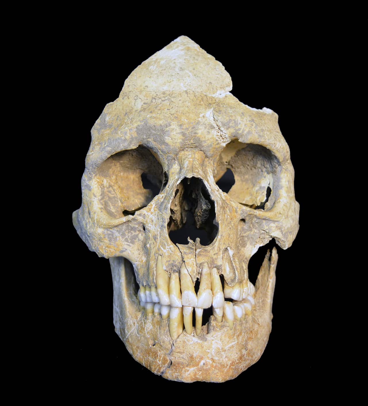 A 7,000-year-old skull of a farmer with hepatitis B that yielded the oldest viral DNA ever recovered from human remains.