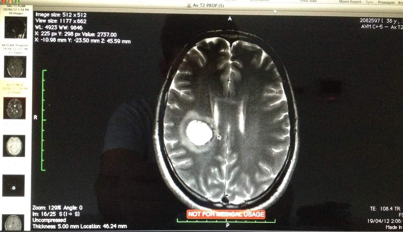 The black and white brain scan