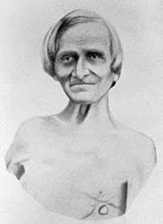 Alexis St Martin