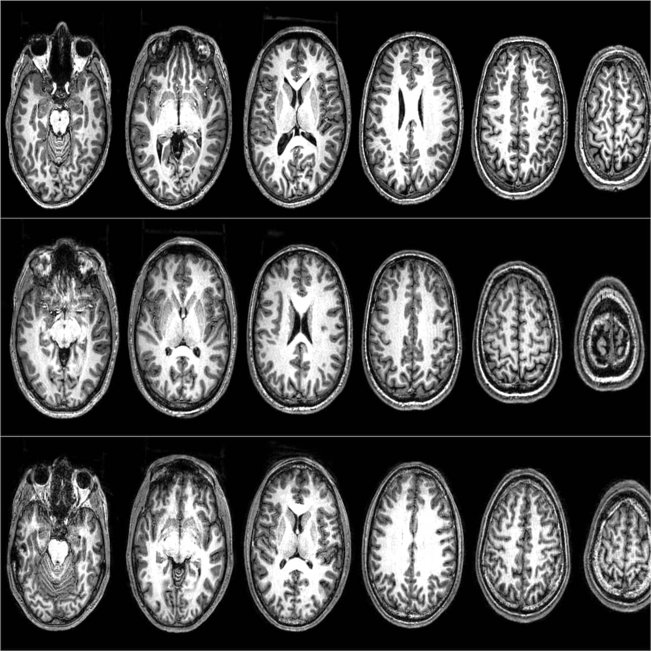 Brain scans from three ‘radicals’ who took part in the Barcelona studies.