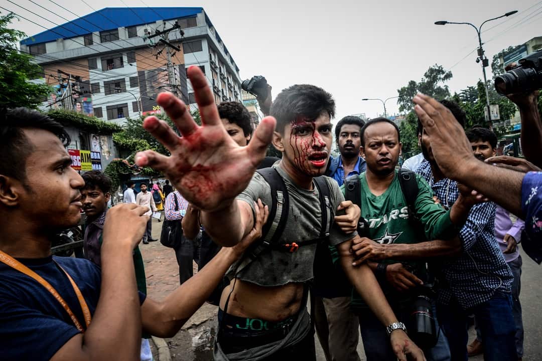A photographer is targeted during in the Dhaka protests.