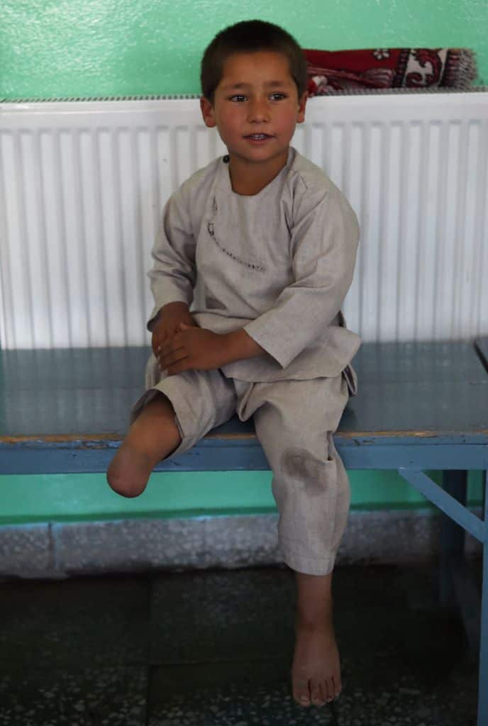 Ahmad has become a social media star in Afghanistan and beyond after a short video of him effortlessly dancing on his new limb was published this week.