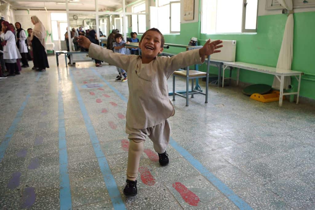 Ahmad lost his right leg when he was hit by a bullet in the crossfire of a battle.