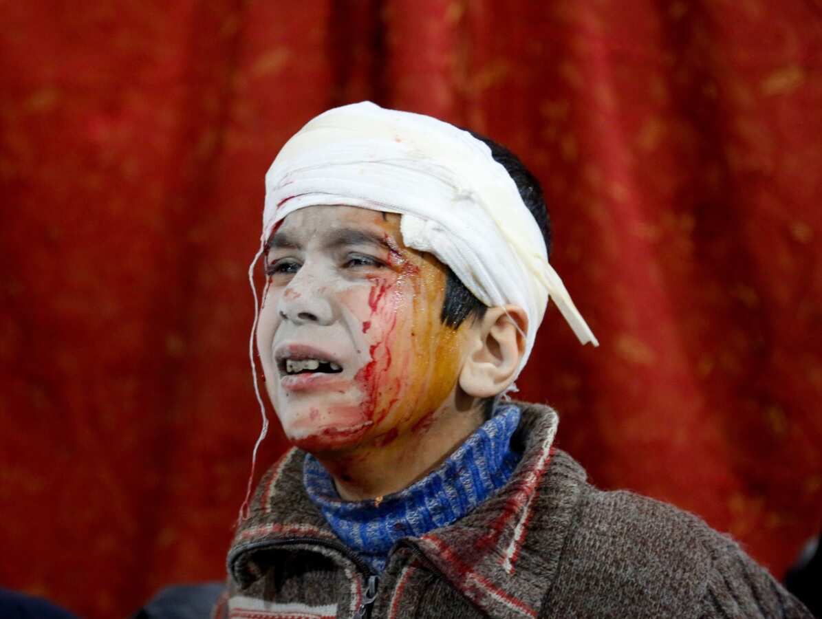 A Syrian kid waits to receive medical treatment at the field hospital after Assad Regime's airstrikes and ground attacks to the Kafr Batna town