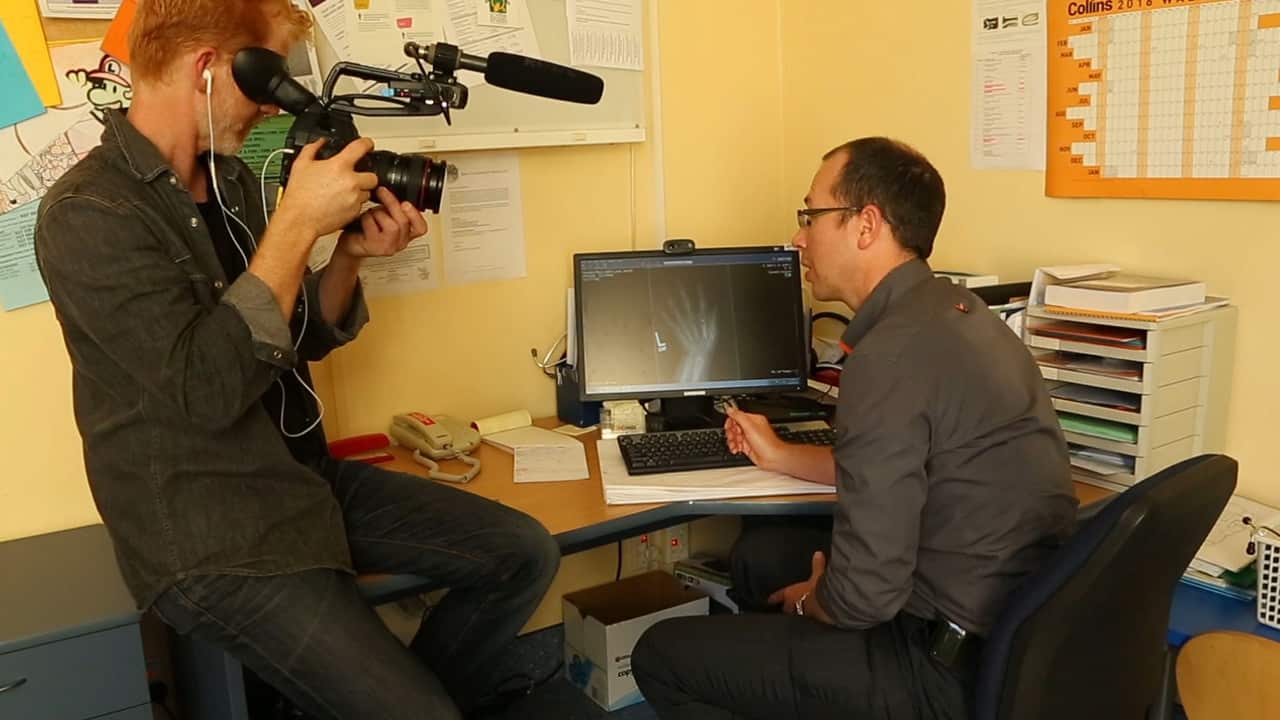 Dateline video journalist Amos Roberts films Dr Ben Wheeler explaining an X-ray of Daryl-Ann's hand. GAT speeds up puberty, causing bone growth to end sooner.