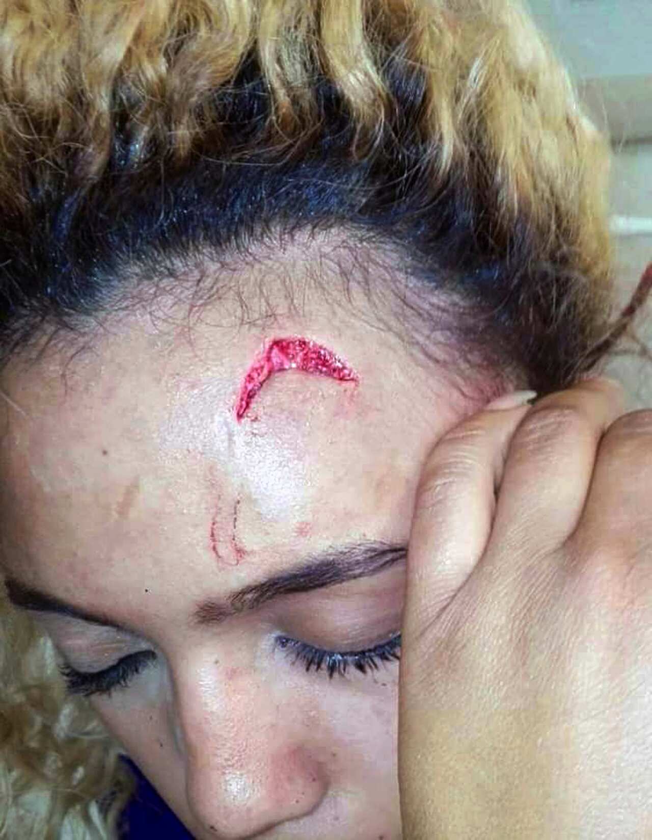 Zimbabwe first lady accused of assaulting model