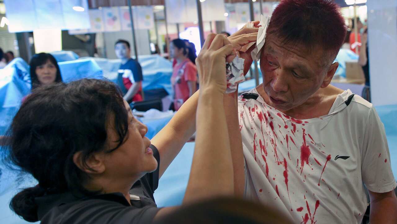 A man bleeding from a head injury is assisted by a woman after anti-government protesters and pro-China supporters clashed at a shopping mall in Hong Kong.