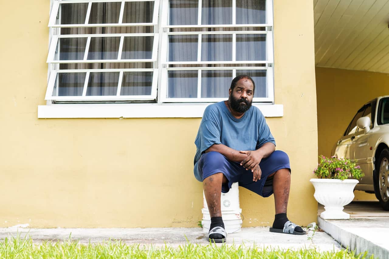 Brent Lowe, 49, who has been blind for 11 years, in front of his brother’s home in Nassau after his dialysis.
