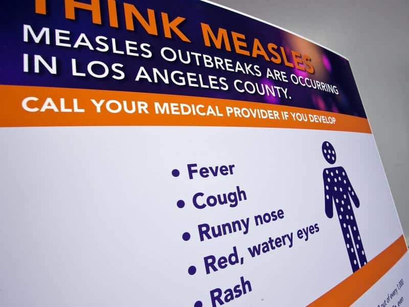 Measles California
