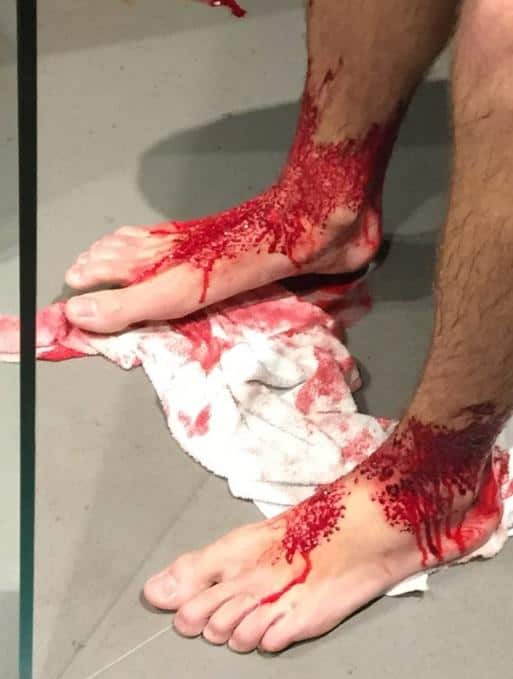 A supplied image of 16-year-old Sam Kanizay in a Melbourne hospital.