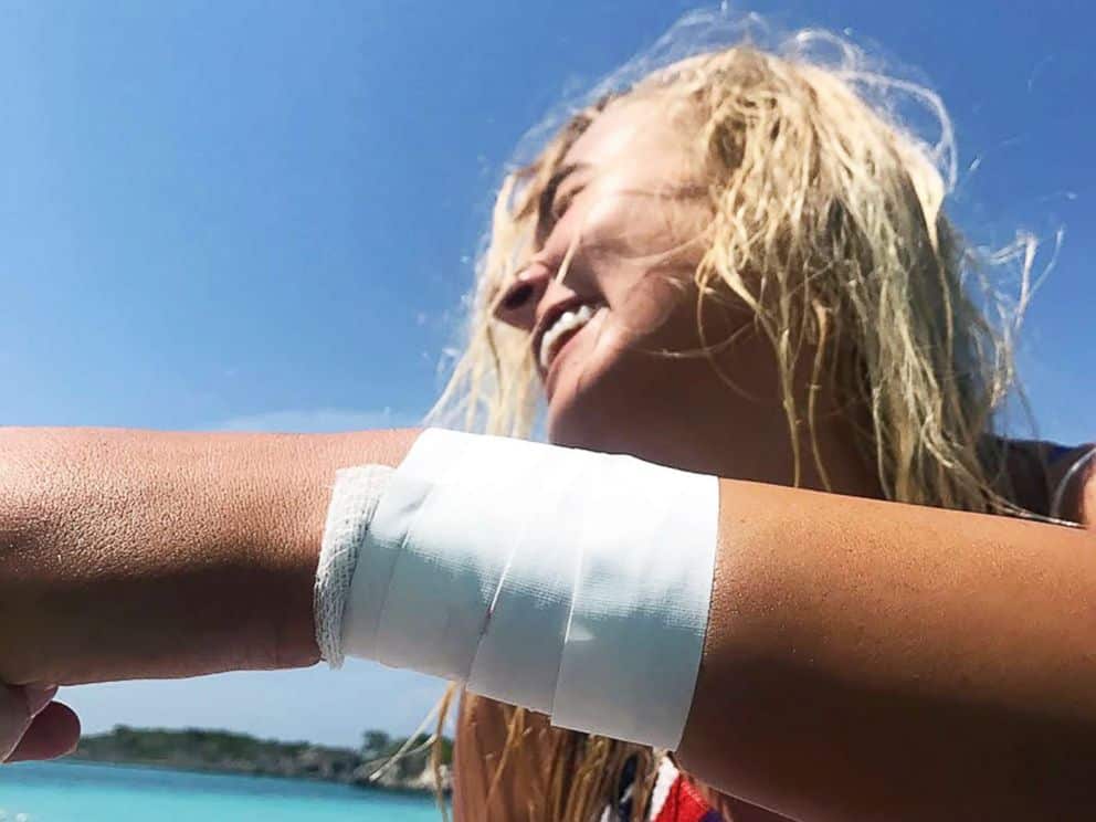 Katarina Zarutskie bandaged up after the incident.