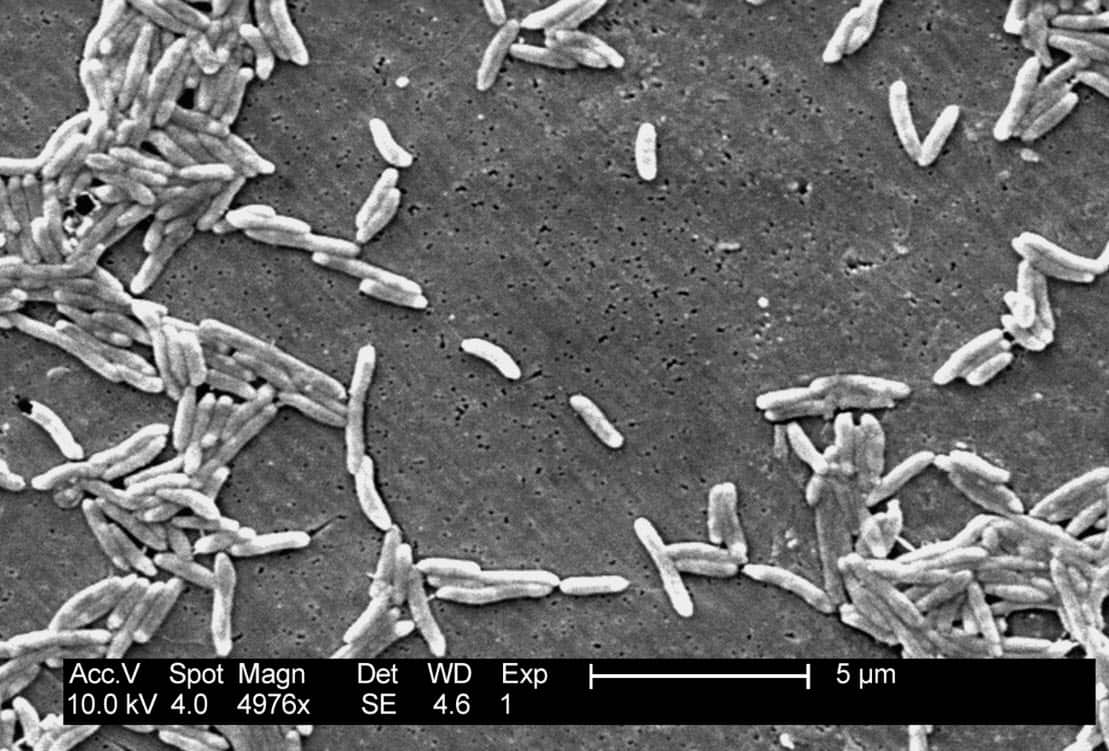 This 2004 electron microscope image made available by the Centers for Disease Control and Prevention shows Gram-negative Campylobacter fetus bacteria (AAP)