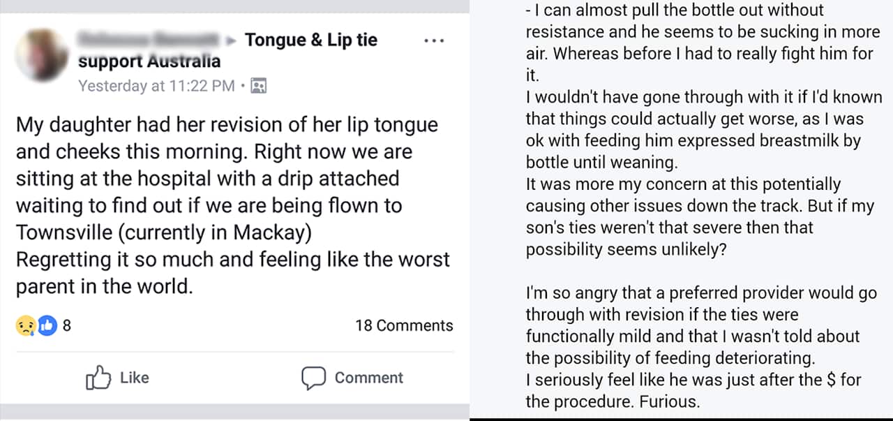 Tongue tie