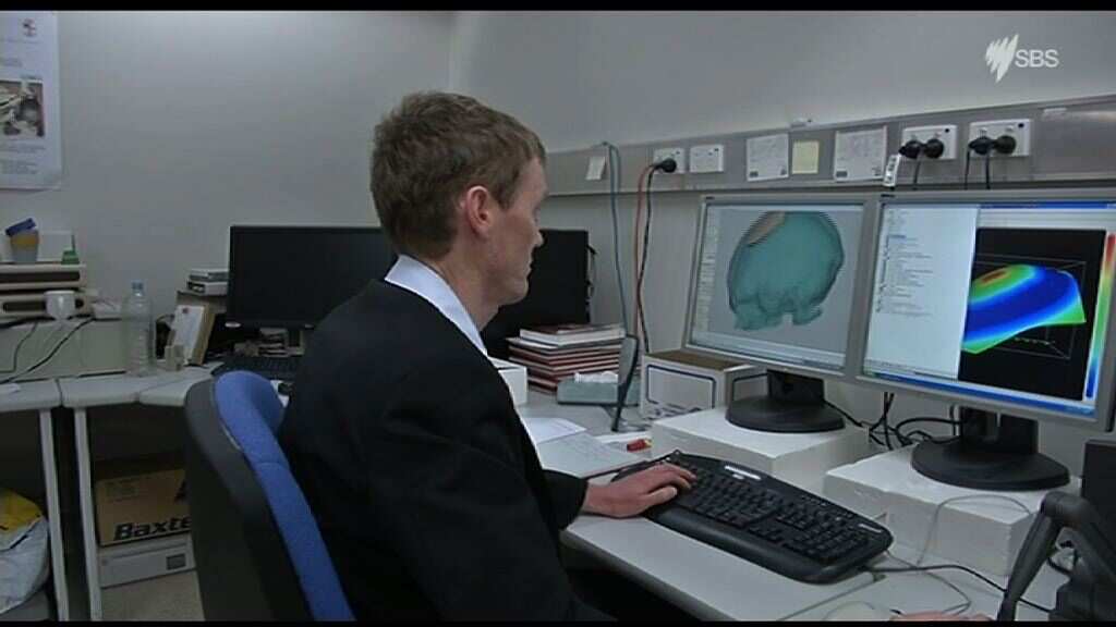Doctors at Royal Perth Hospital hope to use 3D printing and stem cells to grow skull bones.