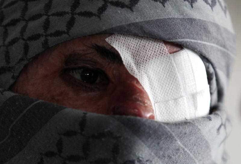 About 50 wounded Houthi fighters were evacuated from the Yemeni capital Sana'a on a plane to Oman for medical treatment ahead of UN-mediated peace talks.