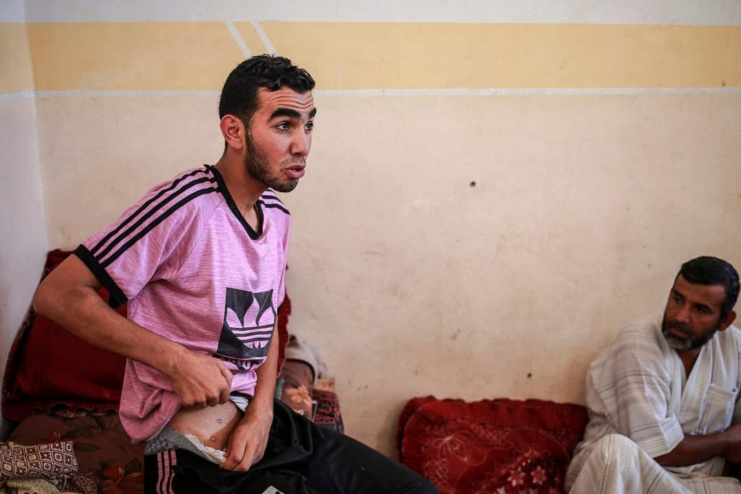 Mohammed Shafee shows wounds from when he was serving as a volunteer medic amid protests on the Gaza / Israel border.