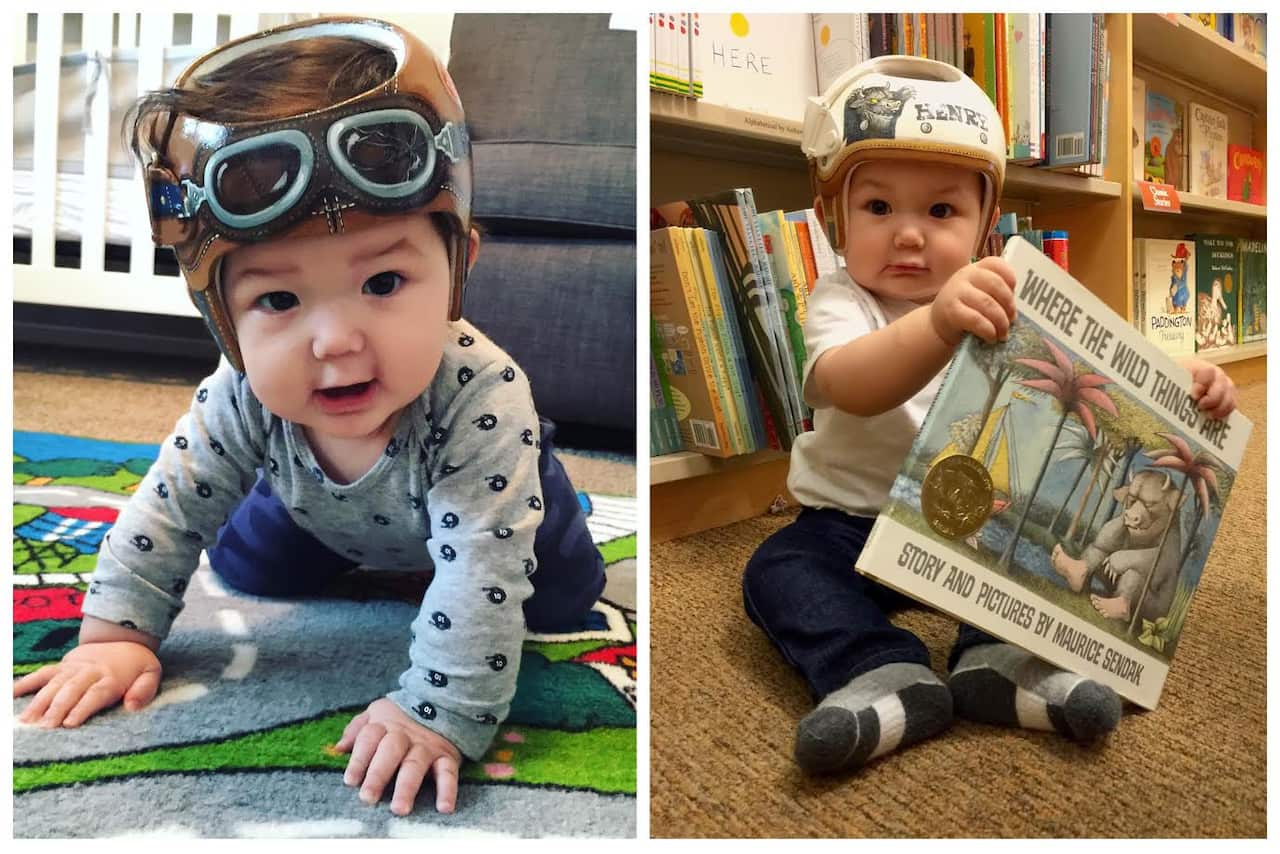Babies wearing corrective helmets