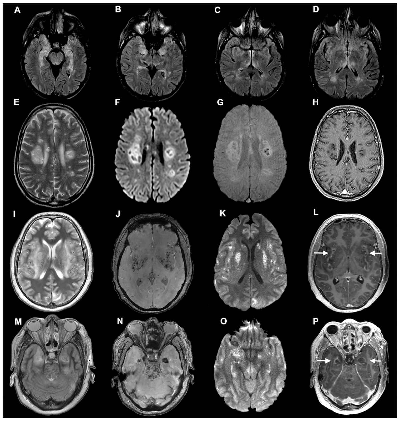 brain