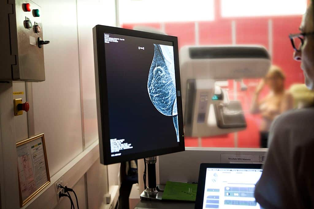 More people could benefit from BRCA breast cancer drugs