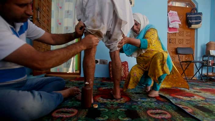 Family members of Gulam Rasool Bhat apply medicine on the pellet wounds inside his home in Srinagar, Indian, Tuesday, Aug. 20, 2019.  (AP Photo/Mukhtar Khan)