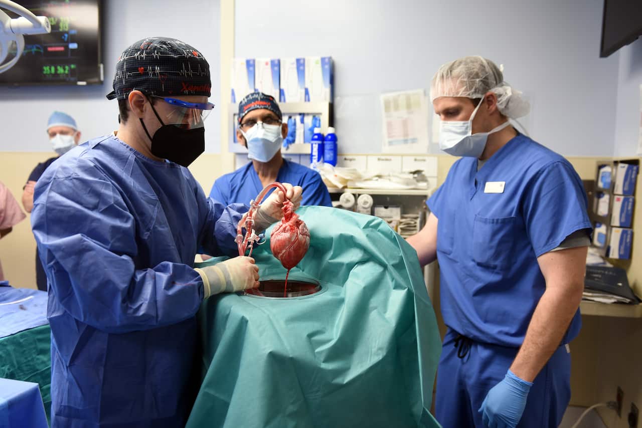 epa09677908 A handout photo made available by the University of Maryland School of Medicine (UMSOM) that shows Surgeon Muhammad M. Mohiuddin, MD (C) leading a team as they handle a genetically-modified pig heart that was a successful transplant in a first