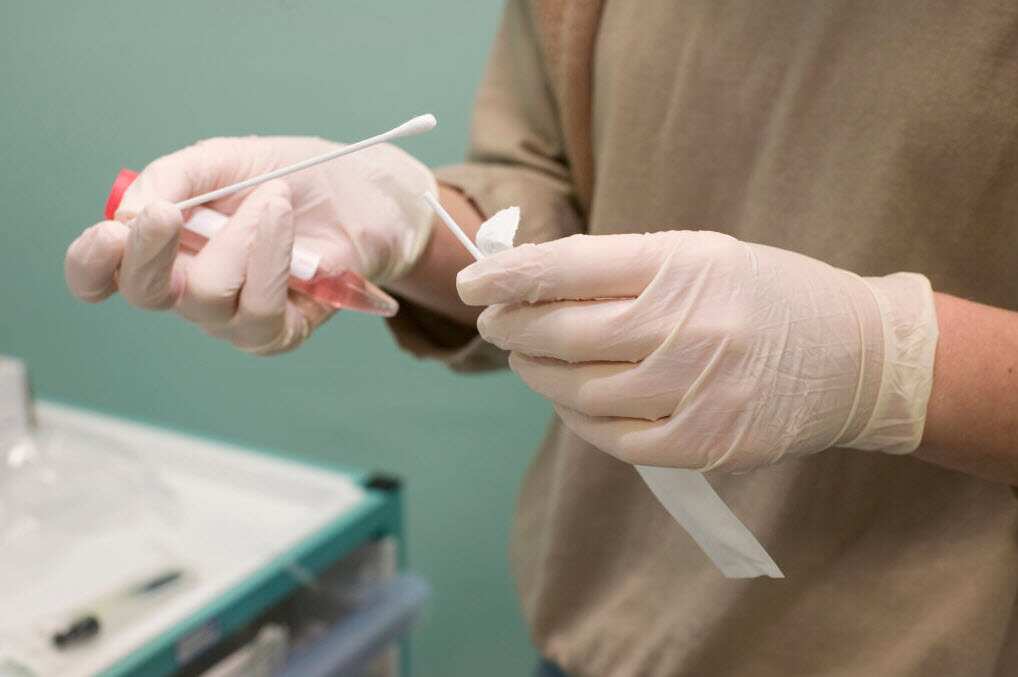 Testing for chlamydia (Getty Images)