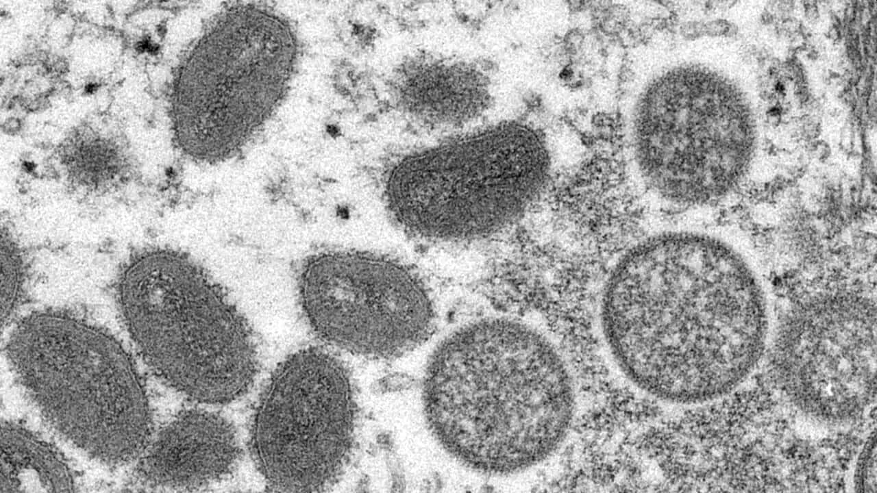 Oval-shaped monkeypox virions (left) and spherical immature virions (right). Health authorities say monkeypox is not easily spread between people.
