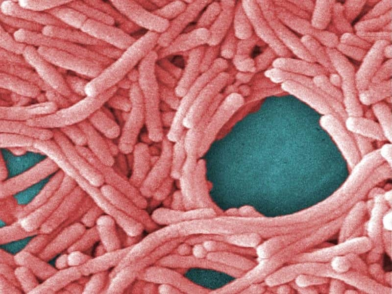 a large grouping of Legionella pneumophila bacteria