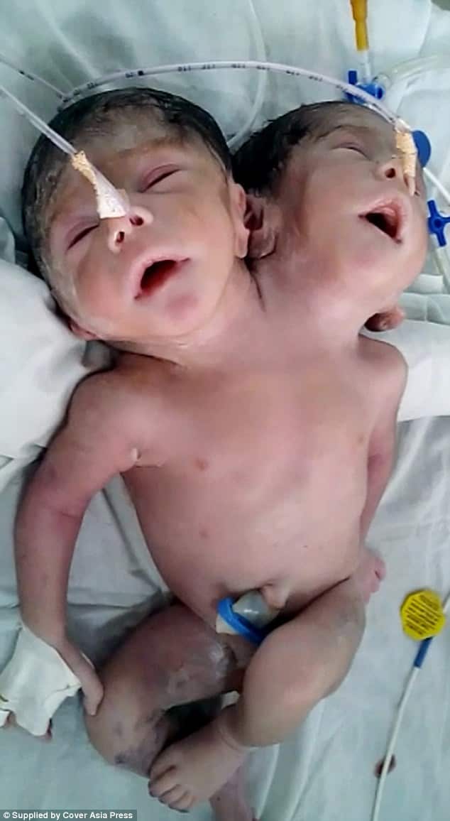 two head