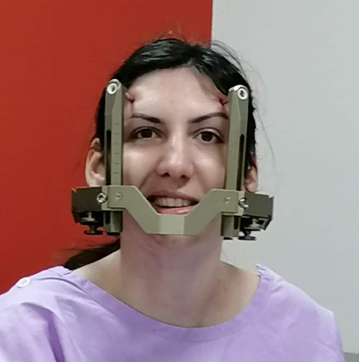 Barbara before her operation