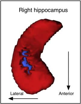 Source: NeuroImage, Dr James Hartzell/ Center for Mind/Brain Sciences (CIMeC) Italy, National Brain Research Centre, (NBRC) India