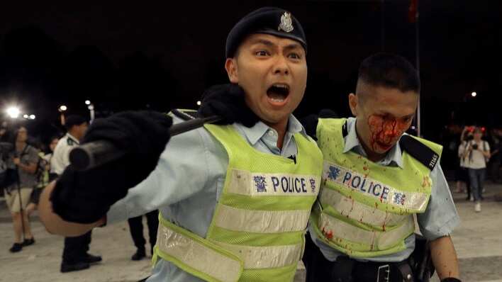 A Hong Kong police officer with blood flowing down his face is assisted by his colleague (AAP)